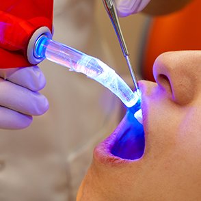 Restorative Dentistry"